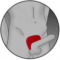 ElectraStim Silicone Fusion Viper BiPolar Cock Ring ElectraStim Silicone Fusion Viper BiPolar Cock Ring